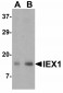 IL-17 Antibody